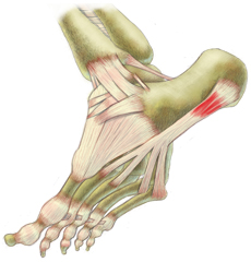King Brand Coldcure Cold Therapy Provides Relief of Pain and Swelling on Foot Injuries King Brand Coldcure Cold Therapy Provides Relief of Pain and Swelling on Foot Injuries